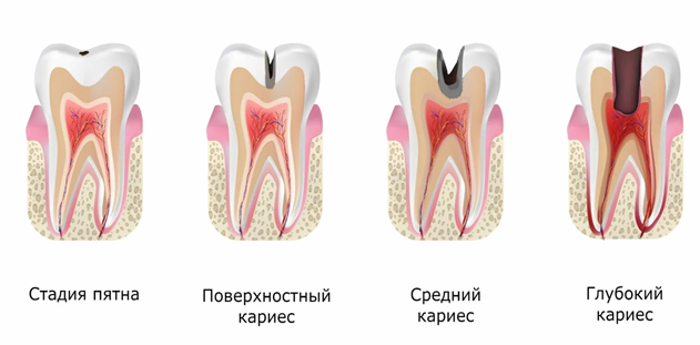 Зубы.png